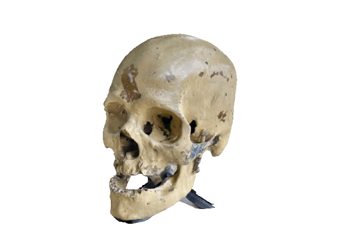 Human skull